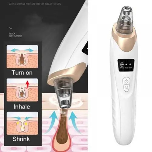 Electric Suction Blackhead