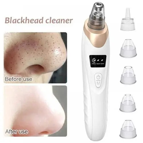 Electric Suction Blackhead